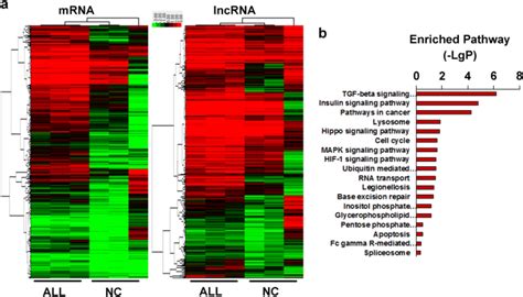 Bone Marrow Infiltrated Lnc INSR Induced Suppressive Immune