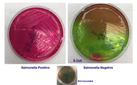 Brilliant Green Agar Results