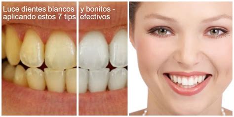 7 Tips Efectivos Para Tener Dientes Blancos Y Bonitos Dientes Blancos