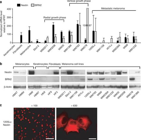 Sox9 And Sox10 But Not Brn2 Are Required For Nestin Expression In Human