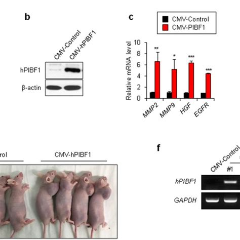 PIBF1 Inhibits The ATR CHK1 Pathway In TNBC Cell Lines A Gene Set