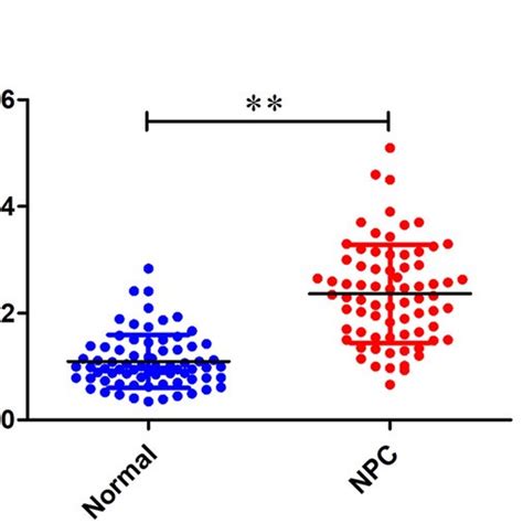 Knockdown Of CRNDE Suppresses Proliferation And Metastasis Of NPC