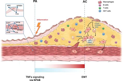 Schematic Of Atherosclerotic Plaque By Anatomic Location Illustrates