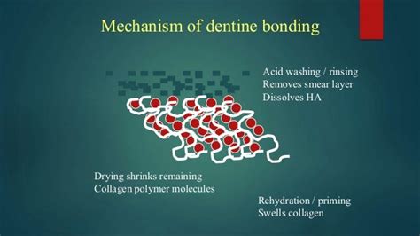 Dentin Bonding Agents