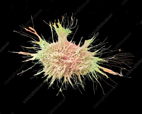 Cervical Cancer Cell Sem Stock Image C Science Photo Library