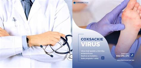 Kako Prepoznati Coxsackie Virus Akta Ba