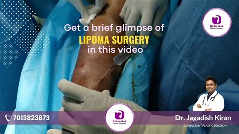 Lipoma Removal Lipoma Lipoma Cost Lipoma Removal Surgery In