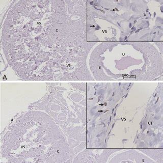 Representative Immunohistochemical Photomicro Graphs Of Adrenomedullin