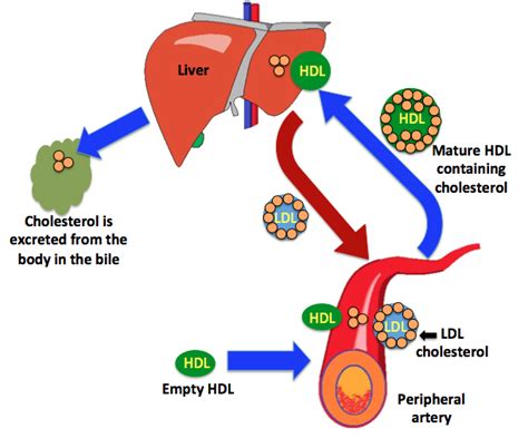 Hdl Cholesterol Sometimes More Is Not Necessarily Better Atlas Of