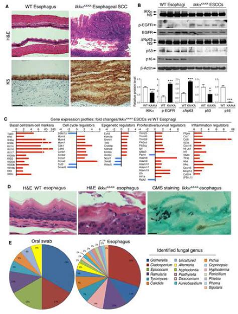 Figure From Autoreactive T Cells And Chronic Fungal Infection Drive