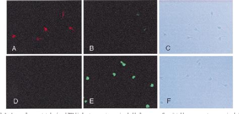 Table 1 From Expression Of Recombinant Human Zona Pellucida Protein 2