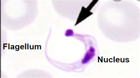 Lecture 18 Hemoflagellates Trypanosoma And Leishmania Flashcards