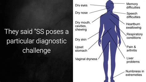 Cutaneous Features And Diagnosis Of Primary Sjogrens Syndrome Youtube