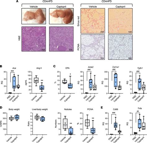 Captopril Prevents Liver Fibrosis Progression And Cancer Development In