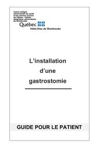 La Gastrostomie Percutanée Endoscopique