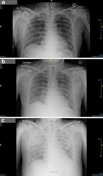 A Portable Chest Radiograph Ap View Looks Normal On Presentation To