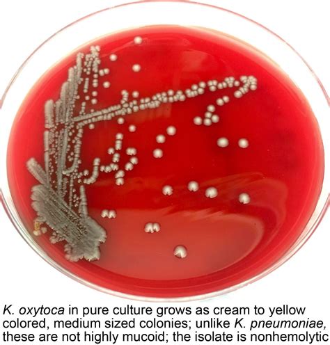 Pathology Outlines Klebsiella Oxytoca