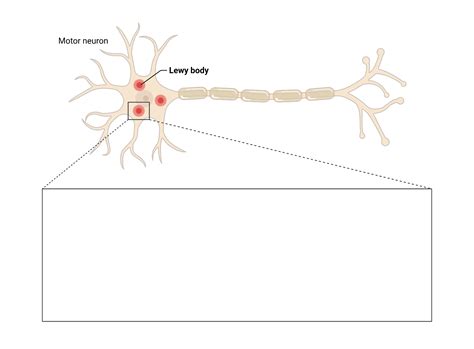 Lewy Body Callout Layout BioRender Science Templates