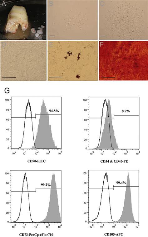 Isolation Culture And Identification Of SCAP The Apical Papilla From