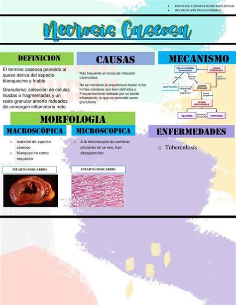 Necrosis Caseosa Braydi Cerda Bueno Udocz