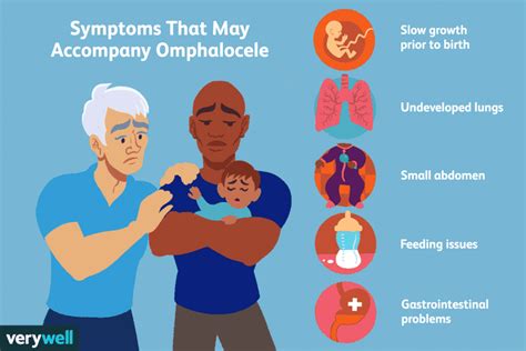 Omphalocele: Treatment, Causes, and More