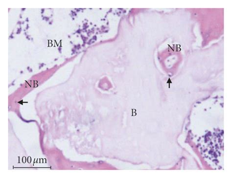 Photomicrographs Showing Bone Formation In Different Groups A B