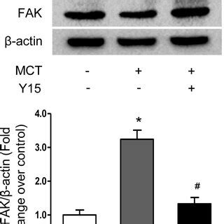 FAK Is Activated In MCT Induced PAH Model The Protein Levels Of P FAK