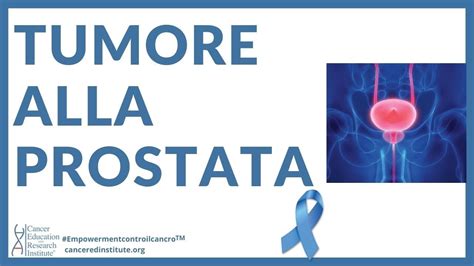 Video Educativo Sul Cancro Tumore Alla Prostata Sintomi Stadio