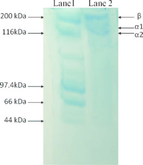 Sds Page Pattern Of Acid Solubilized Collagen Fromarothron Stellatus