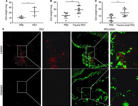 Plateletderived Extracellular Vesicles Released After Trauma Promote