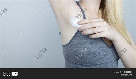 Armpit Rash Underarm Image And Photo Free Trial Bigstock