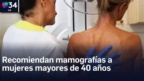 Expertos recomiendan que las mujeres se realicen la mamografía desde