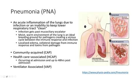 Acute Pulmonary Pathophysiology Atelectasis Bronchitis And