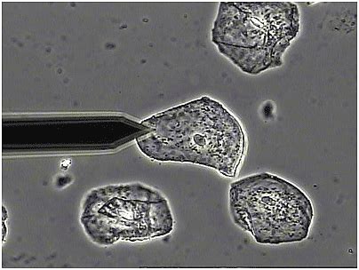 Microscopia De Contraste De Fase