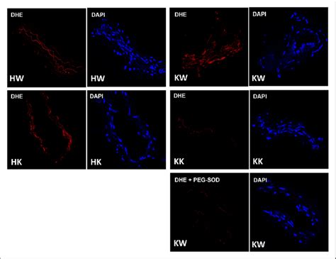 Nox1 Deletion Reduces Superoxide Levels In Mesenteric Arteries Of Dbdb