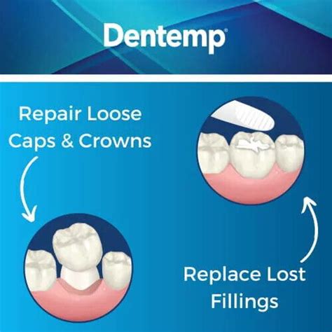 Dentemp Maximum Strength Temporary Cement For Lost Fillings And Loose