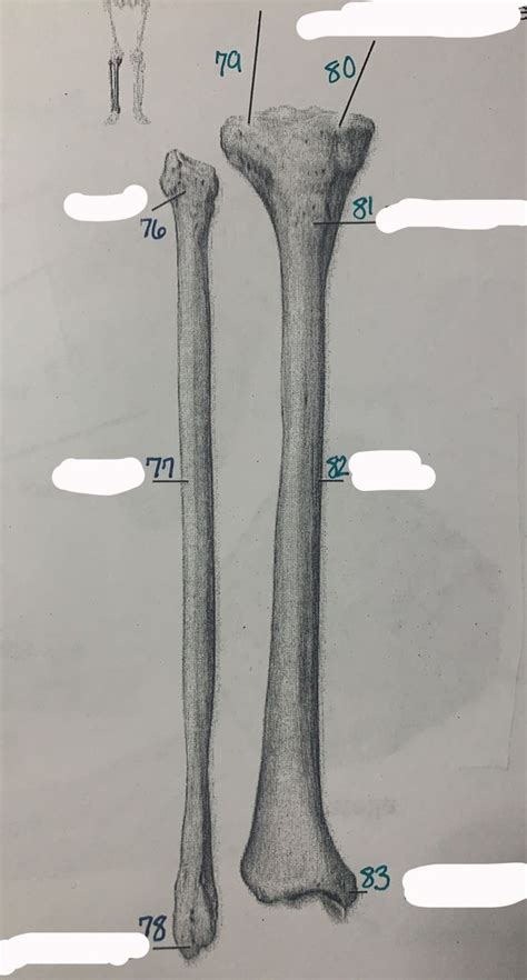 Tibia And Fibula Lab Practical 2 Diagram Quizlet