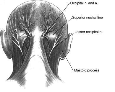 Cranial Neuralgia - Differentiating head pain