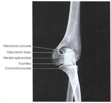 Ap Medical Oblique Diagram Quizlet