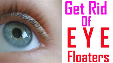 13 WAYS TO GET RID OF EYES Floaters How To Get Rid Of Eye Floaters