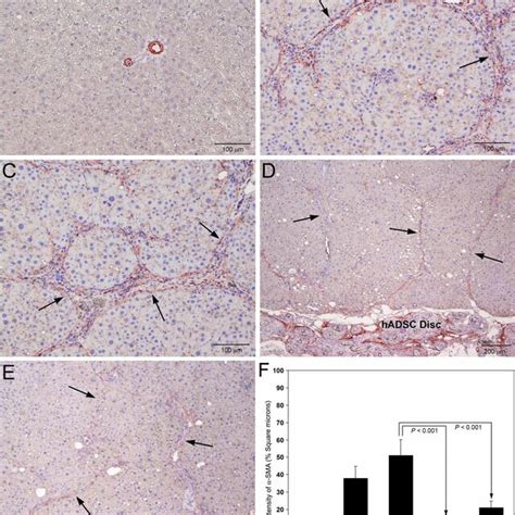 Immunohistochemical Staining Of Smooth Muscle Actin Sma In Rat