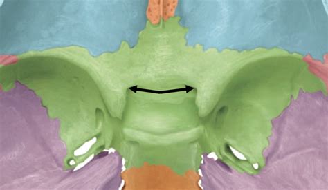 Axial Skeleton Sphenoid Bone Markings Diagram Quizlet