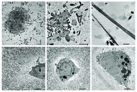 Transmission Electron Microscopy Tem Images Showing A Platelet