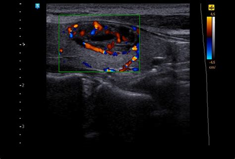 Samsung Hm70a Plus Bio Imaging