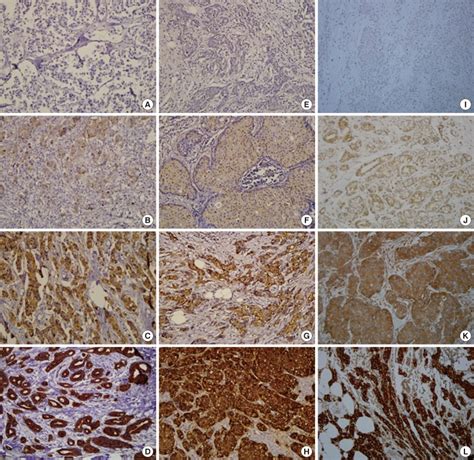 Immunohistochemical results for Tau α tubulin and βIII tubulin Tau