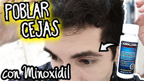 Minoxidil Para Poblar Las Cejas Como Aplicarlo Correctamente Youtube