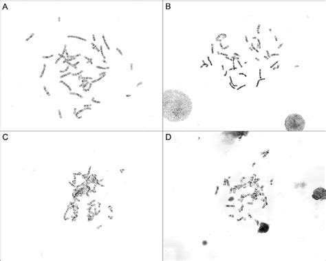 Stained metaphase spreads of varying chromosome morphology and... | Download Scientific Diagram