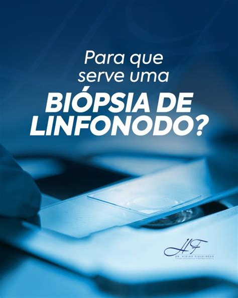 Para que serve Biópsia de linfonodo Dr Higino Felipe