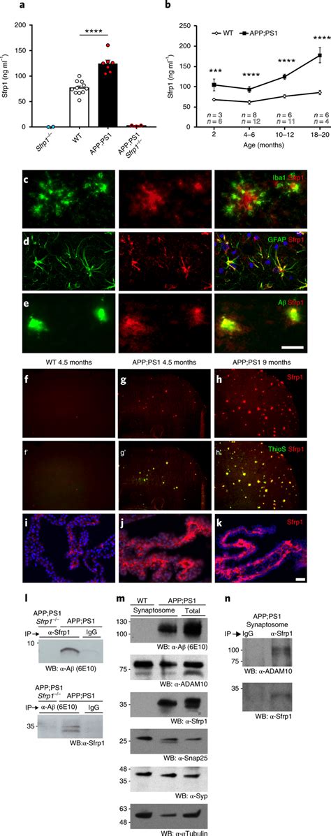 Progressive Upregulation Of Brain Sfrp1 Correlates With The Age Of