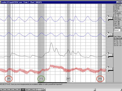 Polygraph Chart